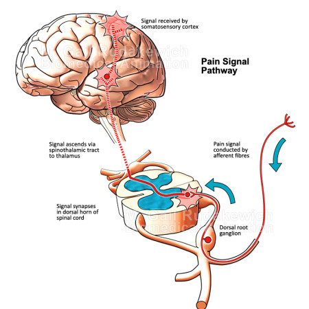 Pain Signal Pathway Illustration