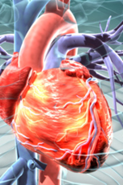 cardiovascular medical device