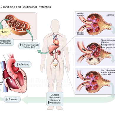 SGLT2 Inhibition & Cardiorenal Protection (Dr. Subodh Verma, St. Michael's Hospital)